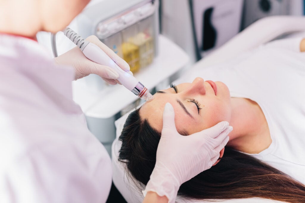 Higiene Hidrafacial Profunda con Radiofrecuencia